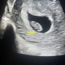 Pregnancy Help Clinic - Ultrasound