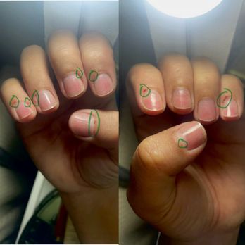 Top Nails & Spa - So many cuts.. I'm so disappointed. - Nail Salons Near Me - Montebello, California