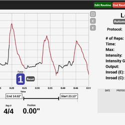 Dynamic Bracing & Physical Therapy - Real time tracking of reps