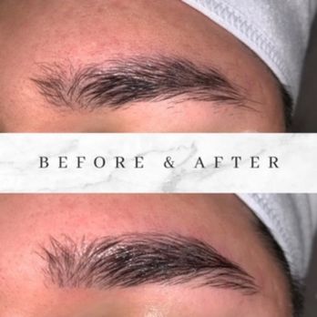 Enhanced Esthetics - Skin Care Near Me - Oceanside, California
