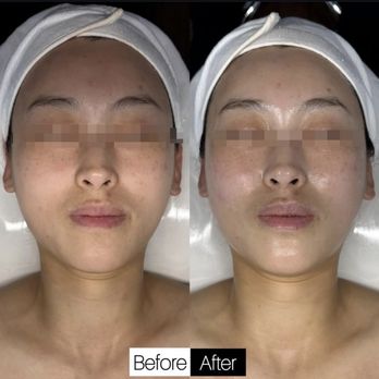 Oz Esthetic - Skin Care Near Me - Vienna, Virginia