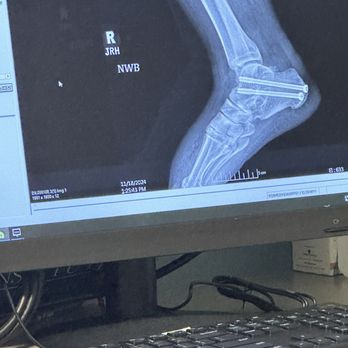Florida orthopedic Institute - Screws that never fused to bone - Sports Medicine Near Me - Brandon, Florida