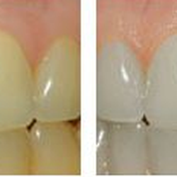 David Drew, DDS