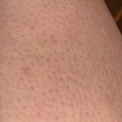 Warm Touch Body Spa - 3 inch picture of my shin showing over 30 hairs not waxed out. All my legs look and feel stubly from top to bottom.