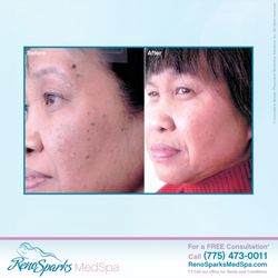 Reno Sparks MedSpa