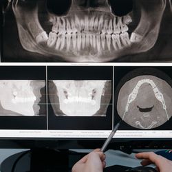 Imperial Dental - Amazing dental work