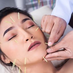 Orlando Natural Medicine And Acupuncture Clinic - We offer Facial Rejuvenation/Cosmetic Acupuncture