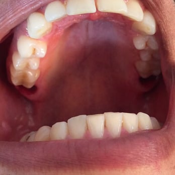 Whittier Surgical Arts - Teeth out Pain out! - Oral Surgeons Near Me - Whittier, California Whittier Surgical Arts - Teeth out Pain out! - Oral Surgeons Near Me - Whittier, California