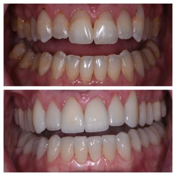 Peoria Dentistry - General Dentistry Near Me - Peoria, Arizona