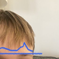 Honey Cuts - Cut was supposed to be at brow