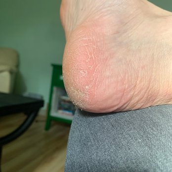LT Nails - This is an example of a piss poor pedicure. - Nail Salons Near Me - Grove City, Ohio