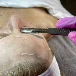 Lydia Sparlin Aesthetics - Dermaplane Facial