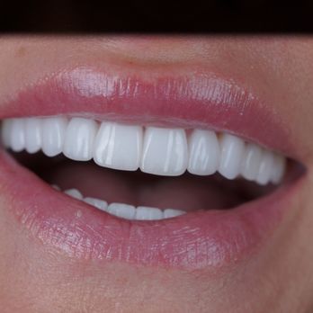 KORsmiles Dental - General Dentistry Near Me - Scottsdale, Arizona KORsmiles Dental - General Dentistry Near Me - Scottsdale, Arizona