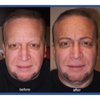 Best Permanent Makeup By Jeffery Lyle Segal gift card