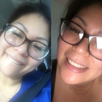 MySmile Dental Care - Cosmetic Dentists Near Me - Anaheim, California