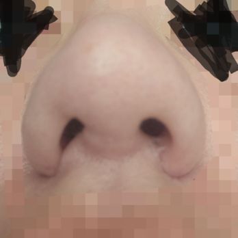 Primera Plastic Surgery - Medical Spas Near Me - Lake Mary, Florida Primera Plastic Surgery - Medical Spas Near Me - Lake Mary, Florida