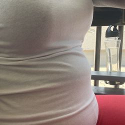 305 Plastic Surgery - 5 months post surgery