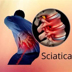 Eastern Shore Chiropractic Center - Treatment for Sciatica