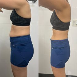 The Glo Company - Weightloss with Tirzepatide.