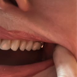 Riverdale Dental Care, PC - Good teeth