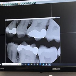 Portsmouth Dental Associates - Digital X-ray