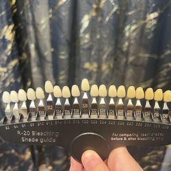 Before and After of my teeth