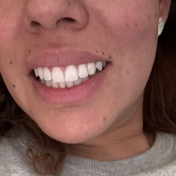 Barsoum Dental Upland - Love my new smile!!! - General Dentistry Near Me - Upland, California