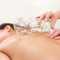 Catawba Natural Healing - Fire cupping relaxes muscle tension and improves circulation. The cups can be placed at acupuncture points for individualized treatments.