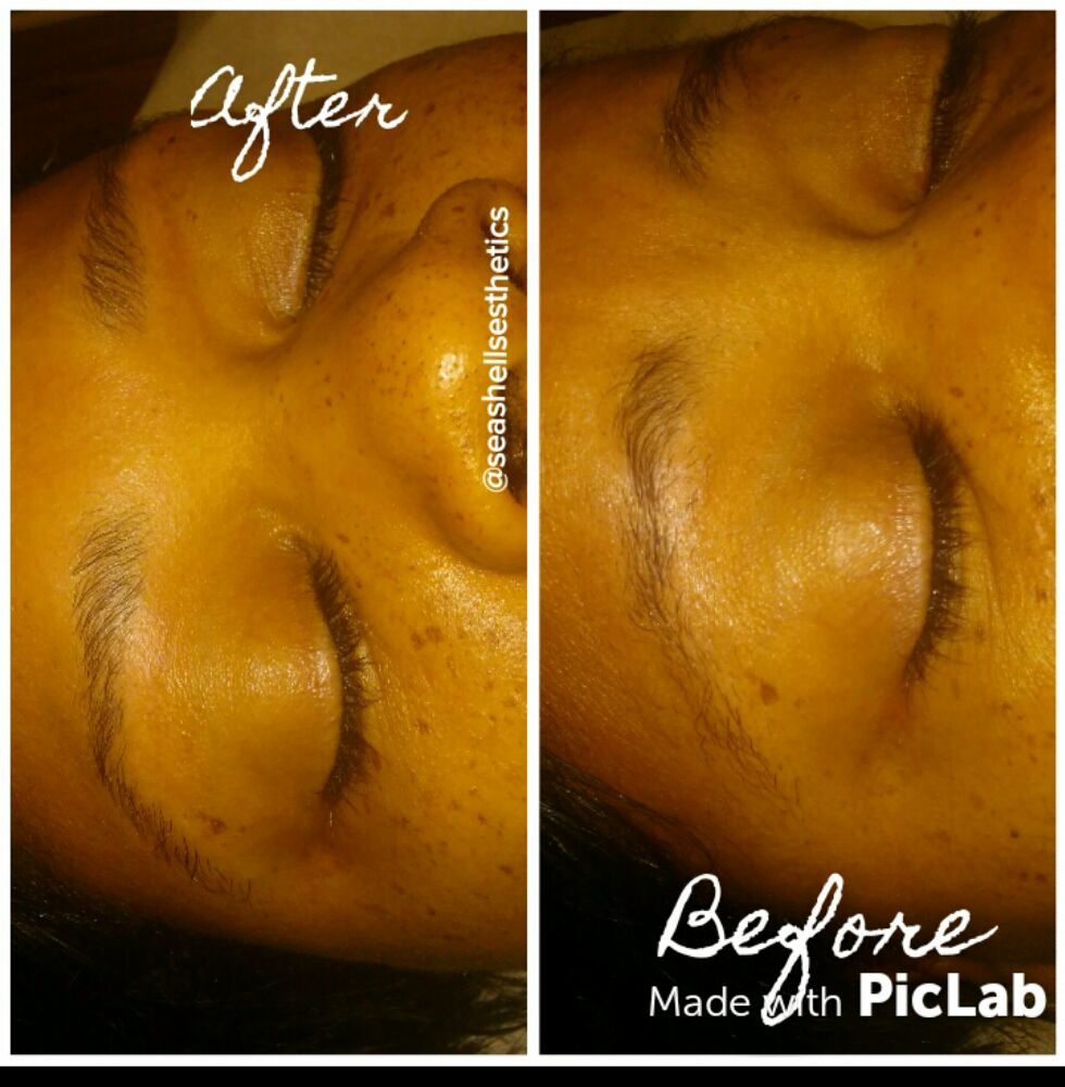 SEA SHELLS ESTHETICS 1114 Sam Newell Road, Matthews, North Carolina