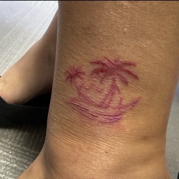 Circus Tattoo - Friends Tatoo 2 weeks later - Tattoo Near Me - Miami Beach, Florida