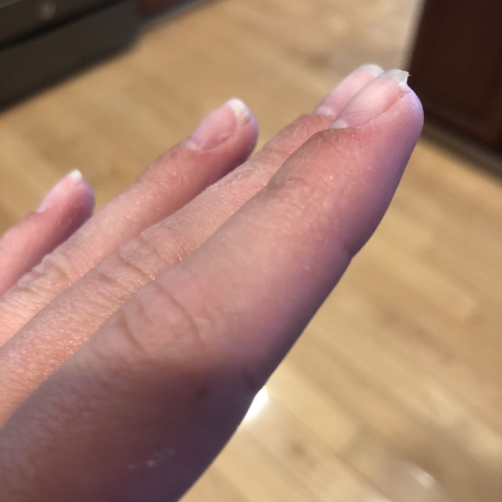 Troy Nails & Spa - Sticky solution still on hands - Nail Salons Near Me - Troy, Michigan Troy Nails & Spa - Sticky solution still on hands - Nail Salons Near Me - Troy, Michigan