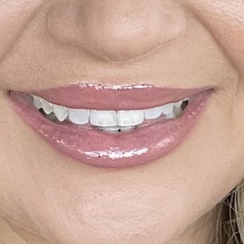 FAB Beauty Bar - Lip filler - Eyelash Service Near Me - Valrico, Florida