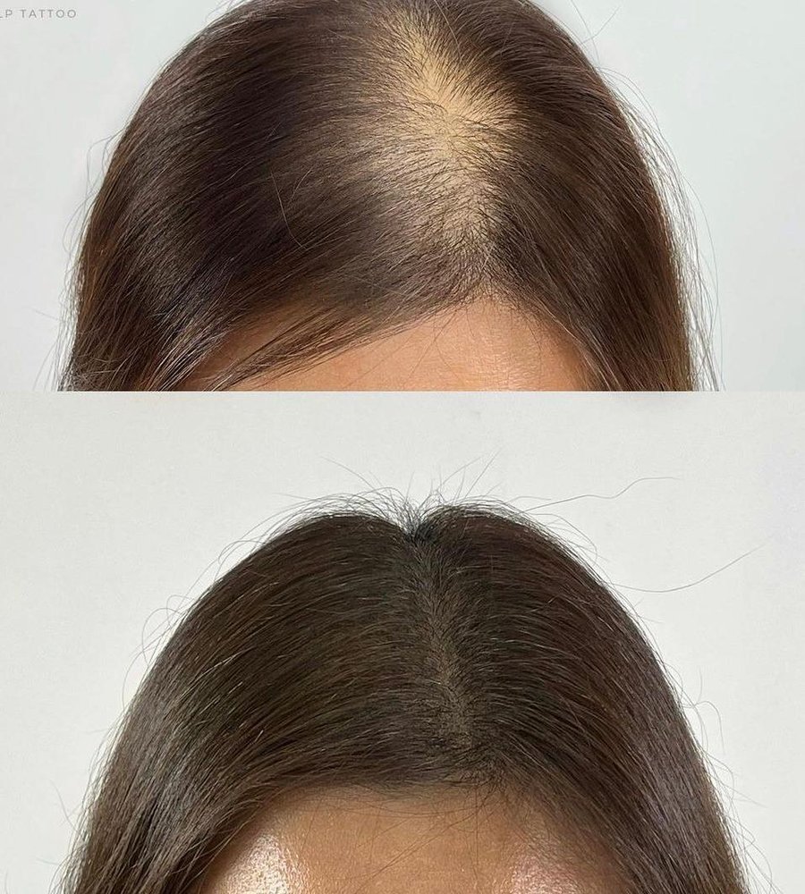 Replica Hair Restoration Logo