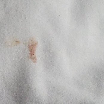 Comfort Inn & Suites Vancouver Downtown City Center - Blood on other pillow - Hotels Near Me - Vancouver, Washington Comfort Inn & Suites Vancouver Downtown City Center - Blood on other pillow - Hotels Near Me - Vancouver, Washington