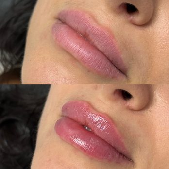 Stark Aesthetics - Medical Spas Near Me - Beverly Hills, California