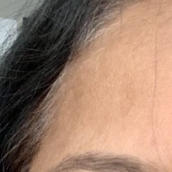 Rita's Beauty Salon - Skin caught in threading