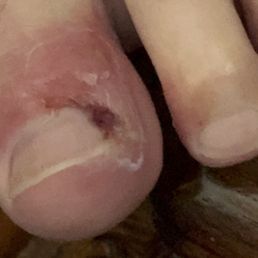 Nail after a pedicure. Nail after a pedicure.