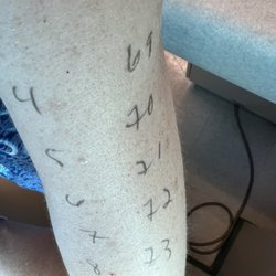 West Hills Allergy and Asthma Associates - West Hills Allergy and Asthma Associates - food allergy testing
