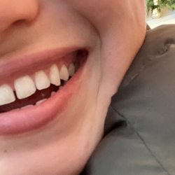 Rosenbaum and Associates - Clean happy teeth courtesy of Dr. Rosenbaum's staff!(: