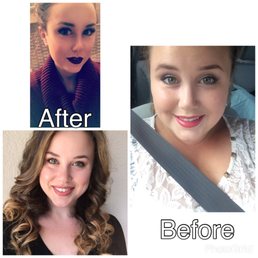 My results after my time at New U Rejuvenation Center