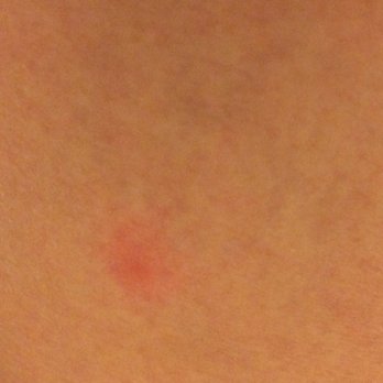 Rodeway Inn - Bed bugs???? - Hotels Near Me - Norfolk, Nebraska