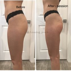 Amazing Peach Massage and Body Contouring