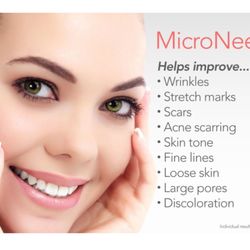 Cara Lash Care & Waxing - Benifit of micro needling treatment