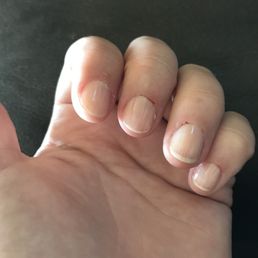 My friend's nails which as you can see from the picture, her cuticles look bloody, and it looks like all she has on is a top coat. My friend's nails which as you can see from the picture, her cuticles look bloody, and it looks like all she has on is a top coat.