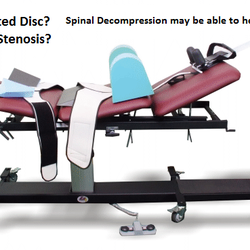 Corrective Care Chiropractic - visit CORRECTIVECC.COM for educational video under Service tab. A solution to sciatica, radiating arm pain, numbness and tingling.