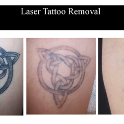 Laser Skin Solutions Jacksonville