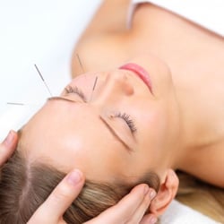 I Love Acu & Tuina Health Center - Acupuncture