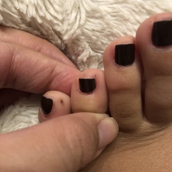 Glossy Nails - More color on the skin. All she needed to do was taking a clean brush with acetone and wipe it off. She kept saying she cleaned it. - Nail Salons Near Me - Rocklin, California