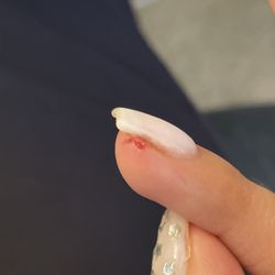 Cathy's Nails - My poor finger hurt for an entire week. The pain would literally wake me in the middle of the night.