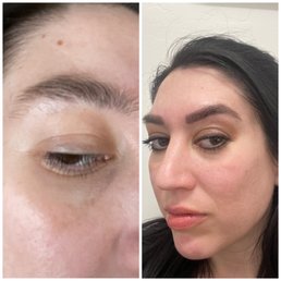 Before and after microblading/eyebrow tattooing Before and after microblading/eyebrow tattooing